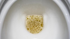 Air Kencing Berbusa: Gejala yang Perlu Diwaspadai?