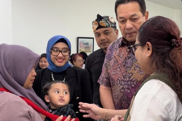 Operasi Bibir Sumbing Gratis untuk Masyarakat Bogor