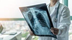 Teknologi Canggih Deteksi Kanker