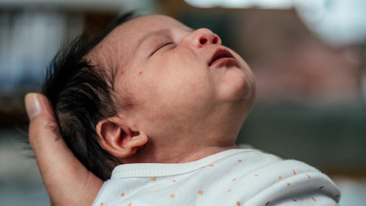 Bahaya Defisiensi Vitamin K pada Bayi