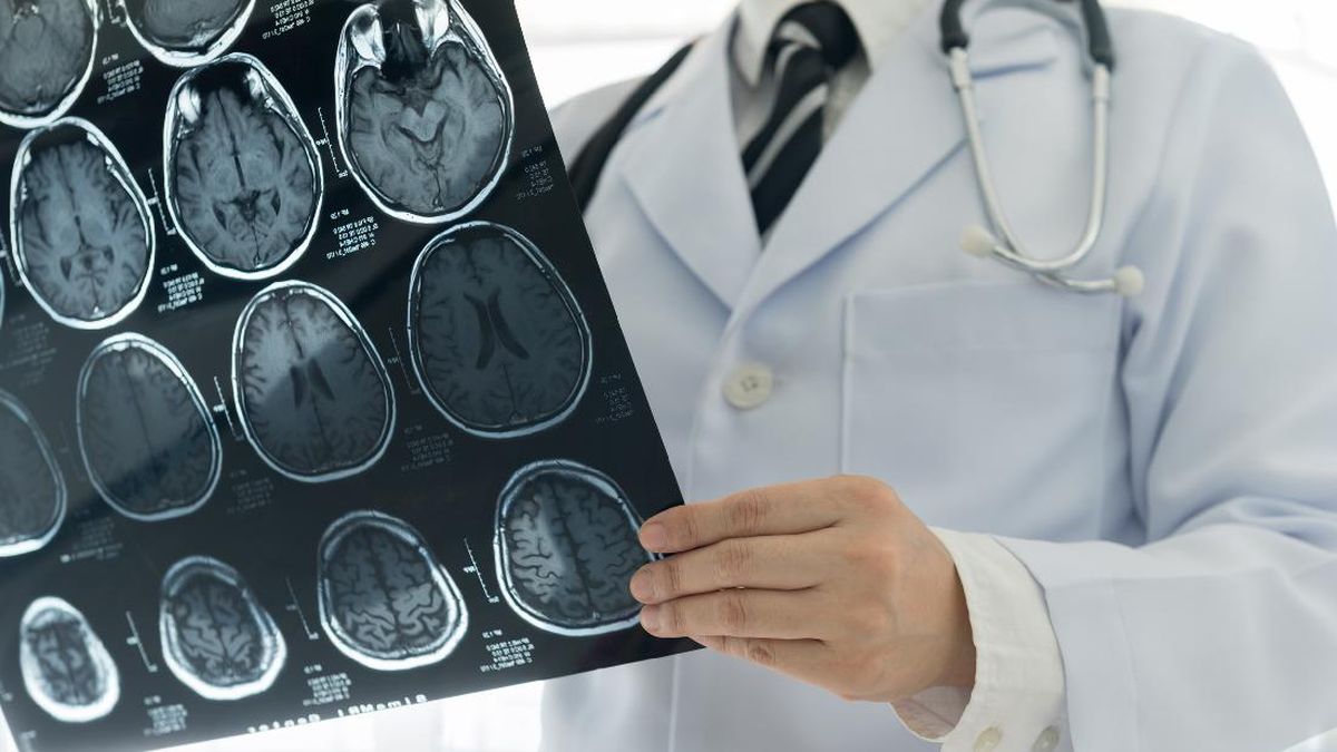 Golongan Darah yang Berisiko Tinggi Mengalami Stroke